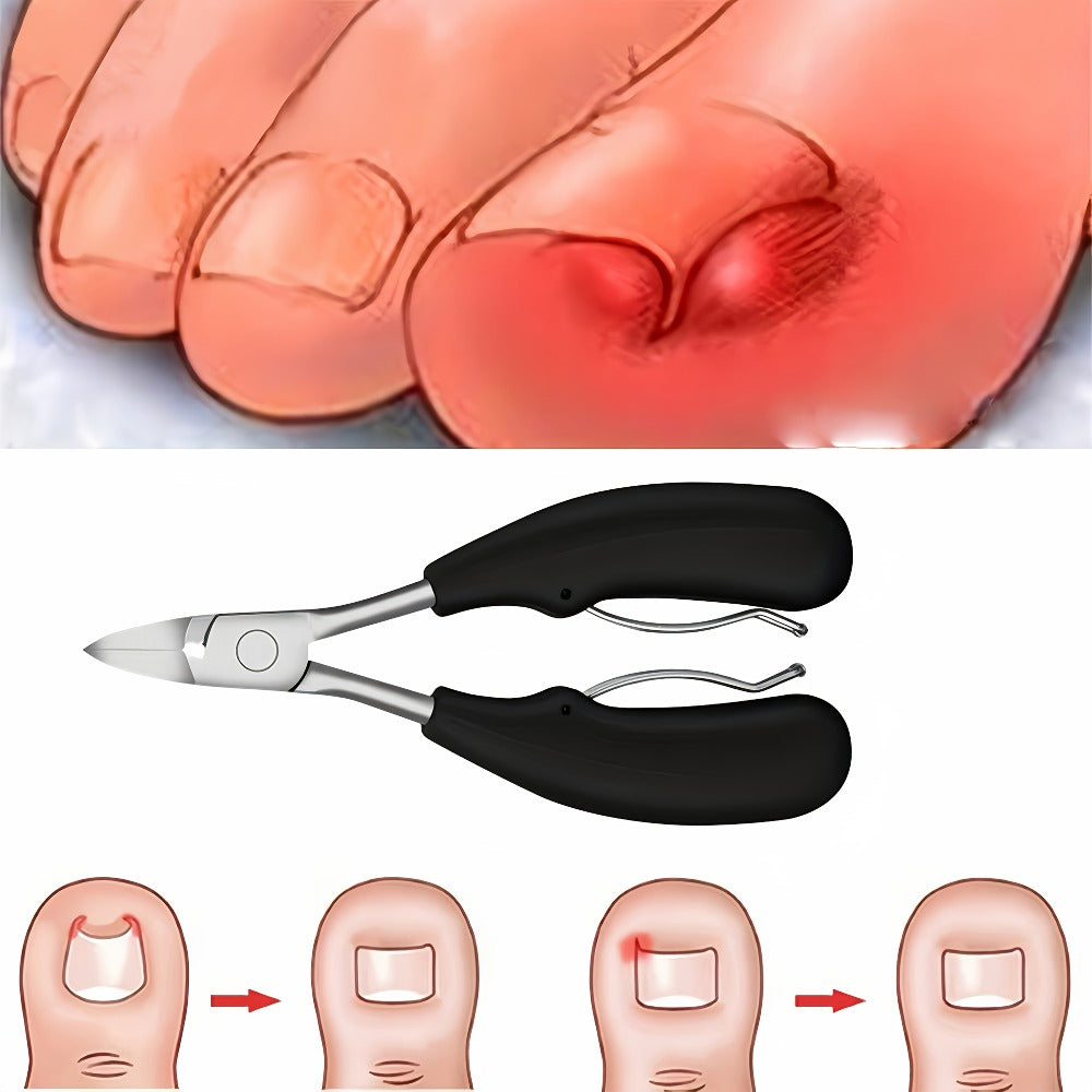 Large Opening Diagonal Blade Toenail Clippers for Thick Nails 5-Piece Set Heavy Duty Stainless Steel Ingrown Toenail Clipper with Nail File for Seniors Men Women Big Toe Cutter Kit - product image 2