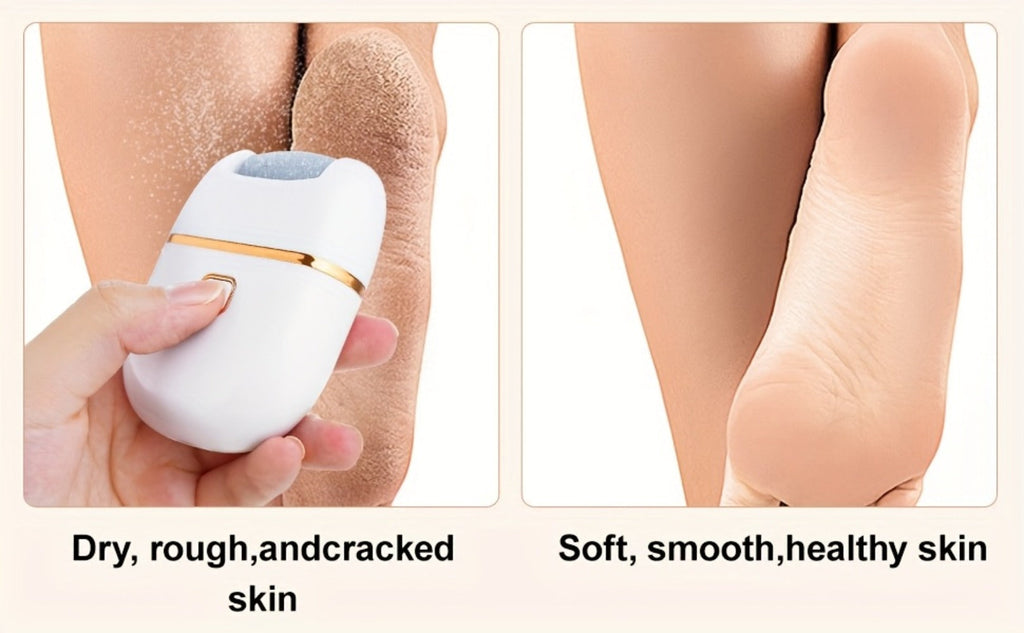 Electric Callus Remover Rechargeable Foot Grinder with 3 Replacement Heads 2 Speed Settings IPX5 Waterproof USB Charging Portable Pedicure Tool for Cracked Heels Dead Skin Women Me - product image 14