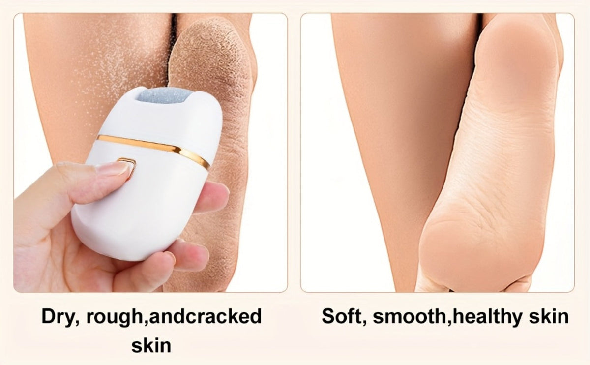Electric Callus Remover Rechargeable Foot Grinder with 3 Replacement Heads 2 Speed Settings IPX5 Waterproof USB Charging Portable Pedicure Tool for Cracked Heels Dead Skin Women Me - product image 14