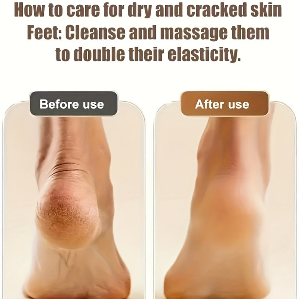 Electric Callus Remover Rechargeable Foot Grinder with 3 Replacement Heads 2 Speed Settings IPX5 Waterproof USB Charging Portable Pedicure Tool for Cracked Heels Dead Skin Women Me - product image 8