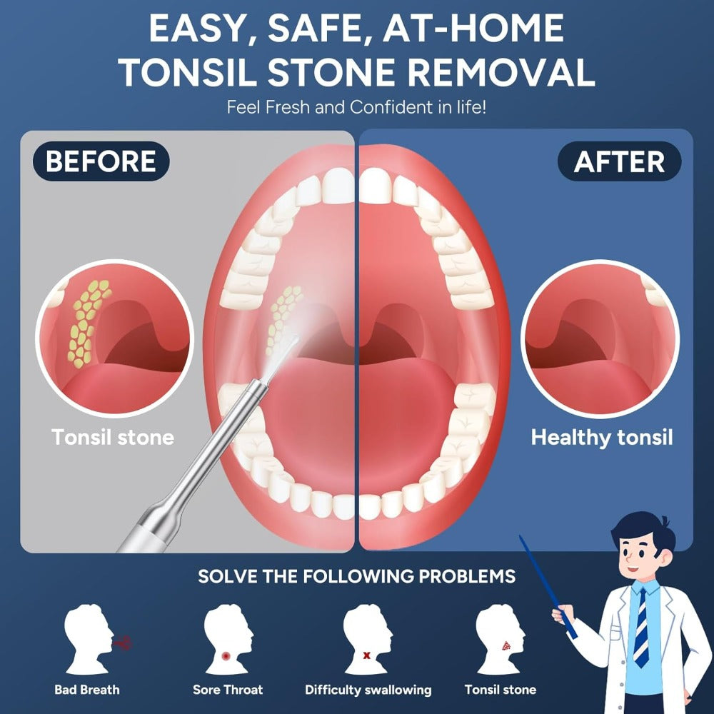 Visual Tonsil Stone Remover with 1080P HD Camera – 6 LED Lights, 5 Stainless Steel Heads, Bad Breath Prevention, iOS & Android Compatible, At-Home Tonsil Care Kit - product image 4