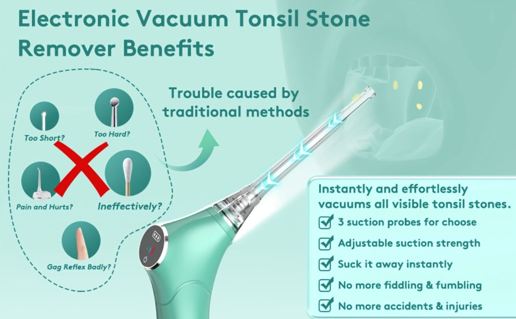 Tonsil Stone Remover Electric Vacuum Kit – Built-In LED Light, 3 Suction Modes & 5X Magnifying Mirror, Oral Irrigator for Safe Effective Tonsil Stone Removal at Home - product image 14