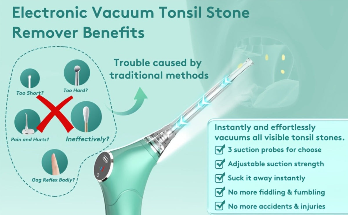 Tonsil Stone Remover Electric Vacuum Kit – Built-In LED Light, 3 Suction Modes & 5X Magnifying Mirror, Oral Irrigator for Safe Effective Tonsil Stone Removal at Home - product image 14
