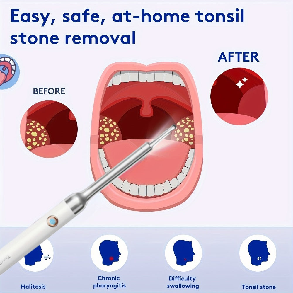 Visual Tonsil Stone Remover with 1080P HD Camera – 6 LED Lights, 5 Stainless Steel Heads, Bad Breath Prevention, iOS & Android Compatible, At-Home Tonsil Care Kit - product image 11