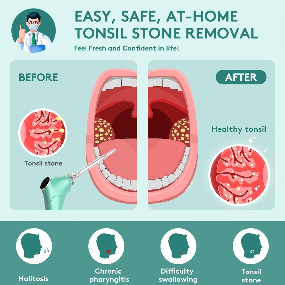Tonsil Stone Remover Electric Vacuum Kit – Built-In LED Light, 3 Suction Modes & 5X Magnifying Mirror, Oral Irrigator for Safe Effective Tonsil Stone Removal at Home - product image 6