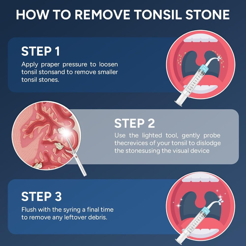 Visual Tonsil Stone Remover with 1080P HD Camera – 6 LED Lights, 5 Stainless Steel Heads, Bad Breath Prevention, iOS & Android Compatible, At-Home Tonsil Care Kit - product image 9