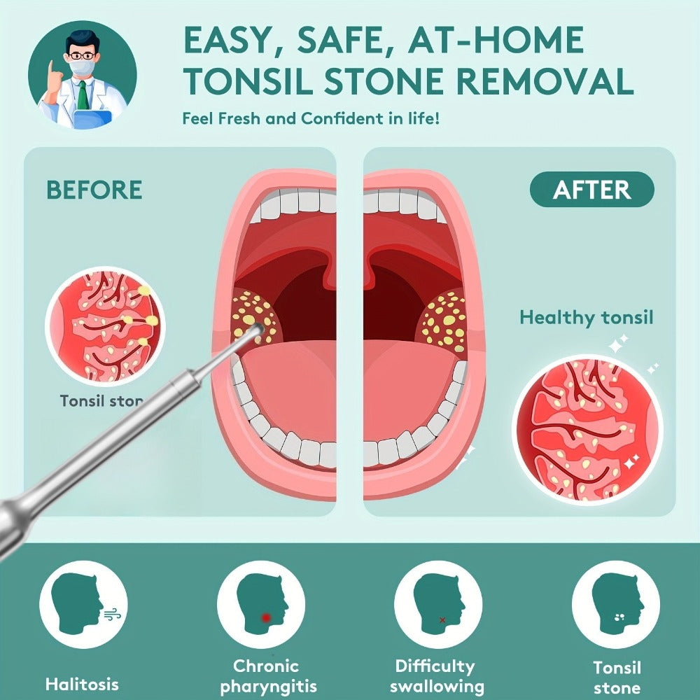 Visual Tonsil Stone Remover with 1080P HD Camera – 6 LED Lights, 5 Stainless Steel Heads, Bad Breath Prevention, iOS & Android Compatible, At-Home Tonsil Care Kit - product image 3