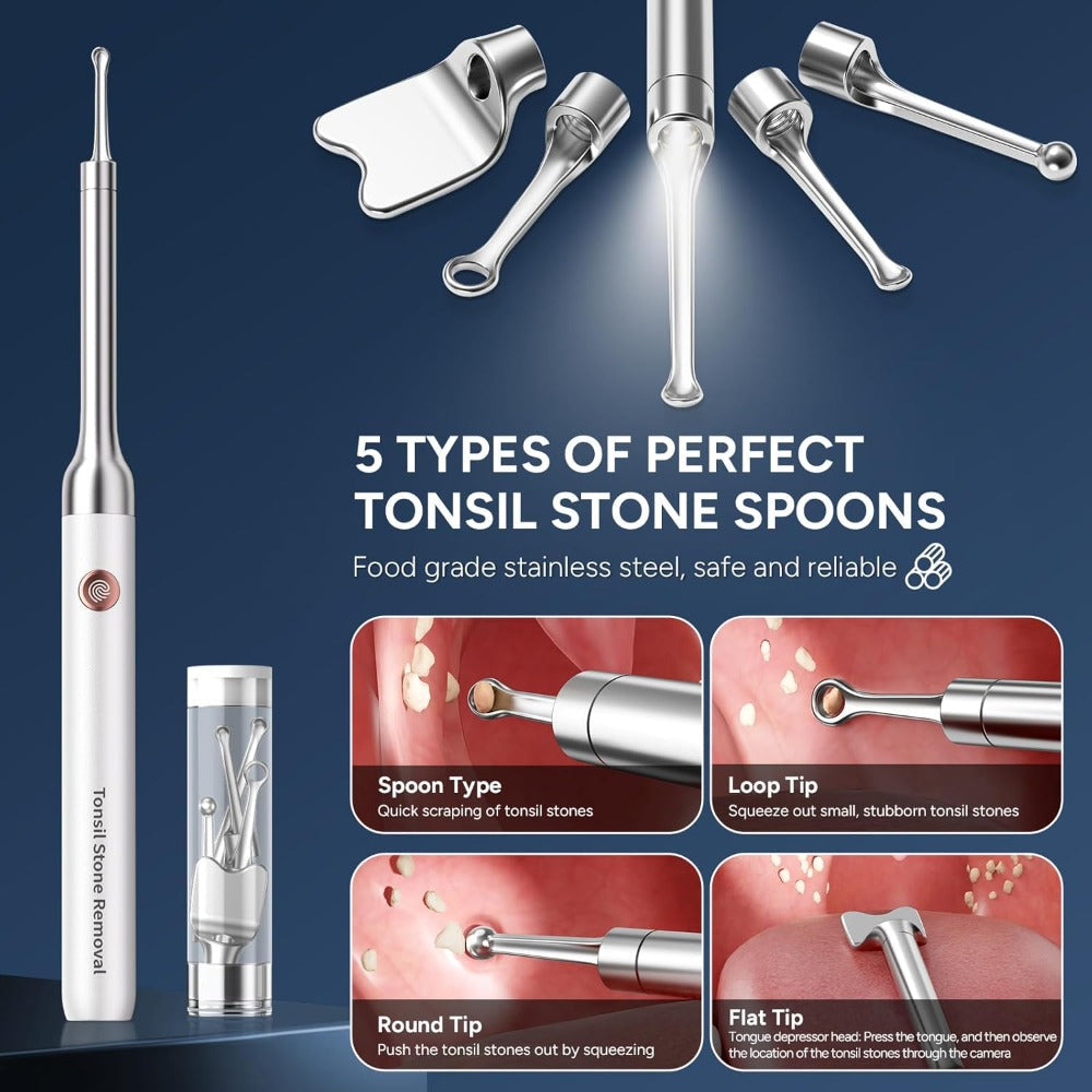 Visual Tonsil Stone Remover with 1080P HD Camera – 6 LED Lights, 5 Stainless Steel Heads, Bad Breath Prevention, iOS & Android Compatible, At-Home Tonsil Care Kit - product image 6