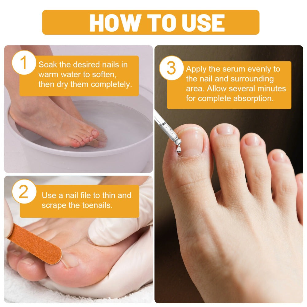 Toenail Repair Solution with Bee Venom Extra Strength Formula for Damaged Discolored Brittle Nails Nail Restoration Serum Visible Results in 7 Days 1.01 fl oz 30ml - product image 8