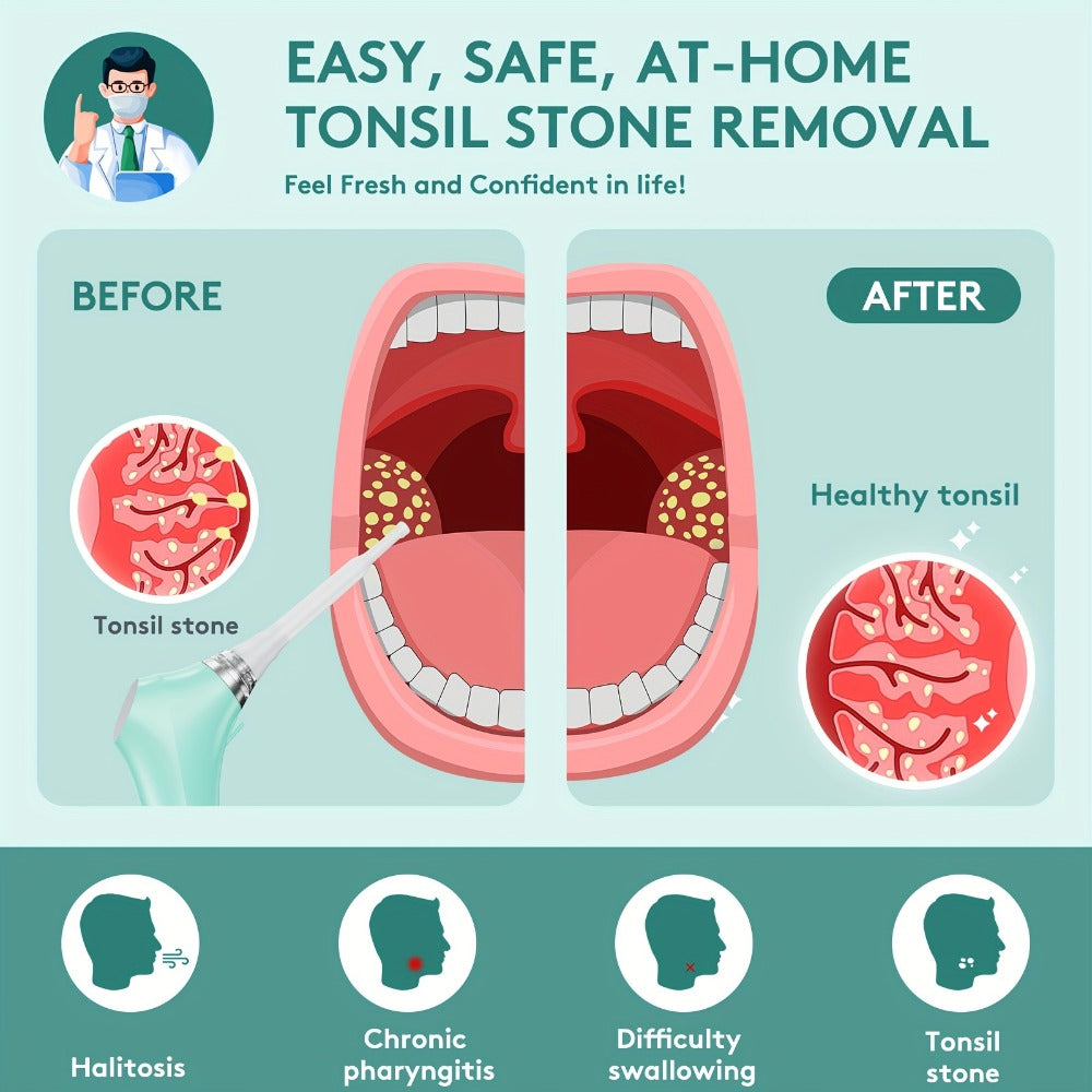 Tonsil Stone Remover Electric Vacuum Kit with LED Light – 3 Suction Modes 5X Magnifying Mirror Oral Irrigator Safe Gentle Tonsillolith Removal Tool for Adults at Home Use Rechargea - product image 6